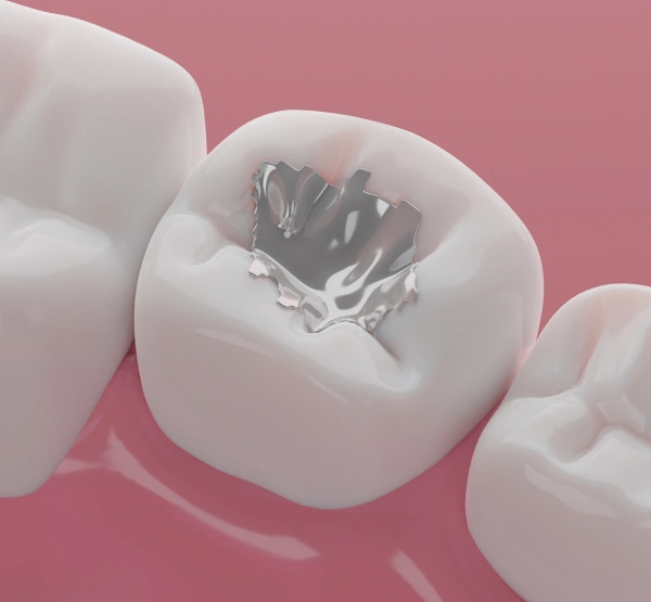 Dental cavity shown on white tooth model against pink background for dental education.