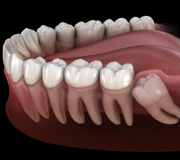 Anatomical illustration of human teeth and gums showing dental structure and root placement.