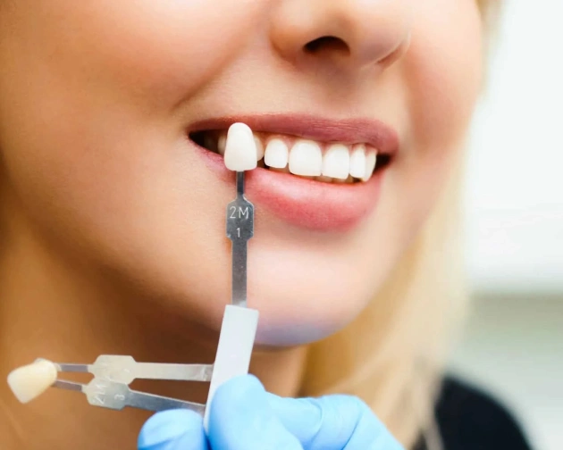 Woman smiling while dentist holds shade guide against her teeth for color matching during dental consultation.
